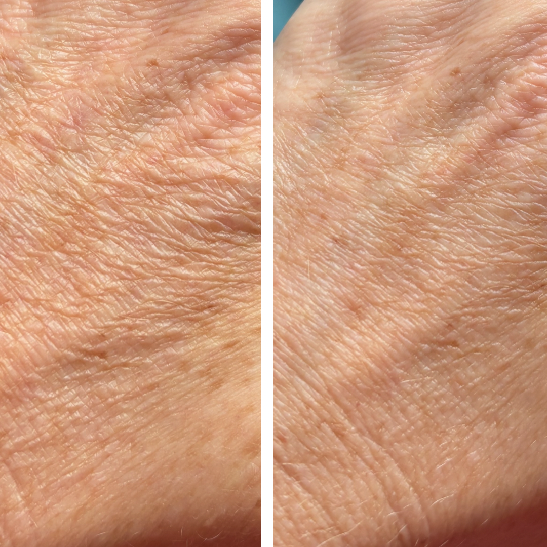Hydrating Lotion